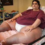 Britain’s Fattest man passes away aged 33, airlifted out of bed by CRANE